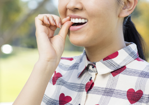 invisalign