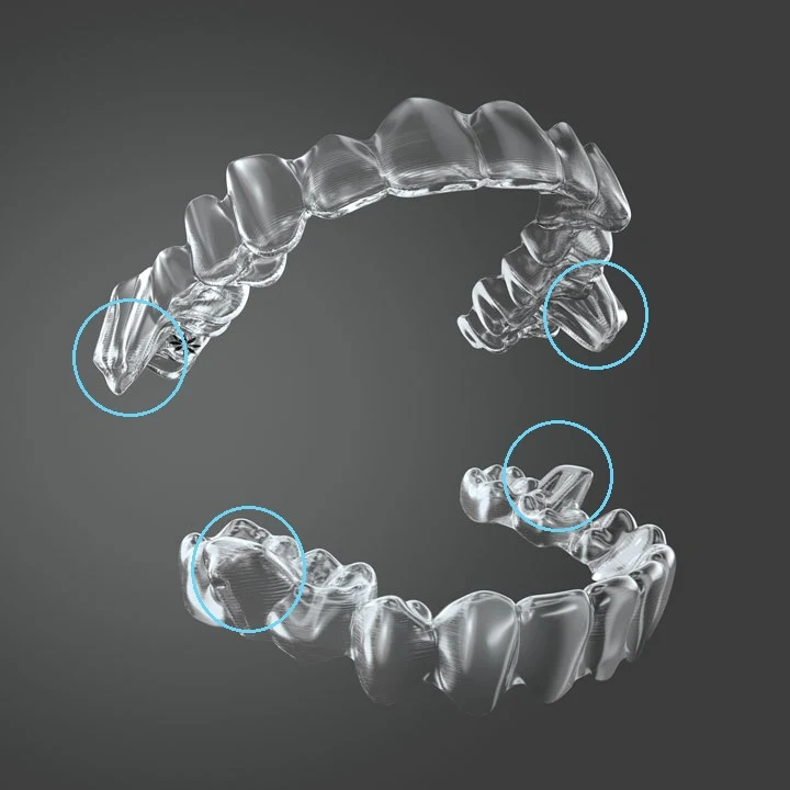 alinhadores transparentes invisalign